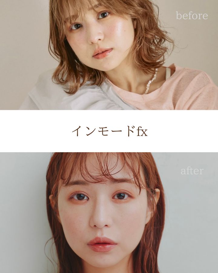 インモードfx