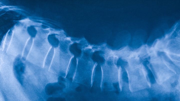 脊椎が切れたラットが「人工培養脊髄」の組み込みで再び歩けるように