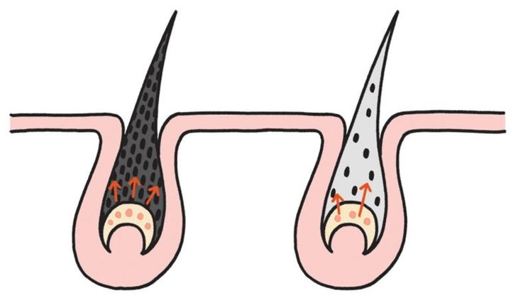 白髪ができるメカニズム