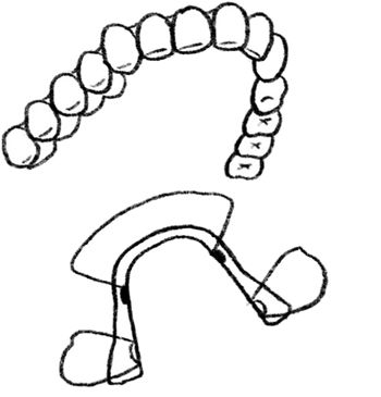 子どもの歯列矯正、何歳から始める？ どのようなものがある？ 矯正した方がいいケースとは？【最新号からちょっと見せ】の画像1