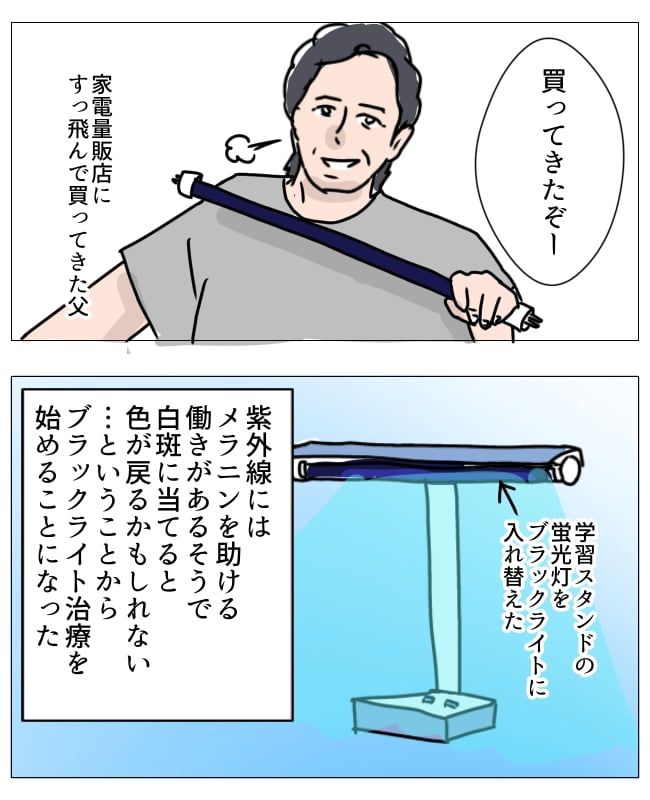娘の尋常性白斑／フワリー