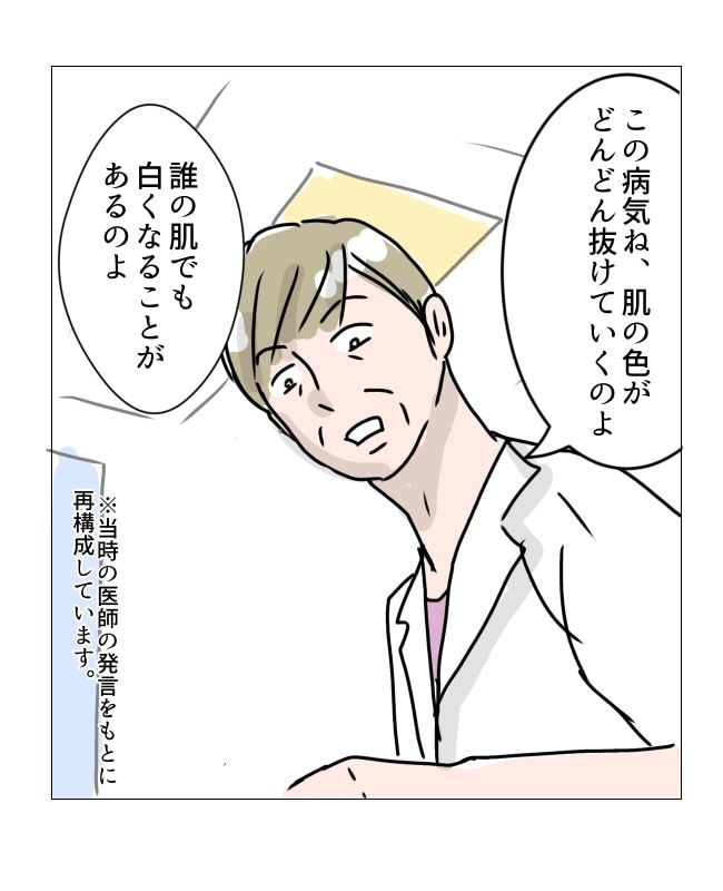 娘の尋常性白斑／フワリー