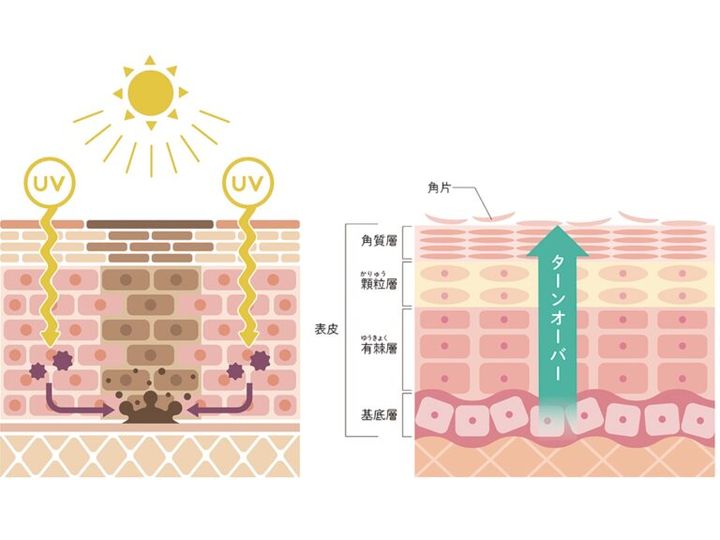 ターンオーバーが乱れるとトラブルのもとに