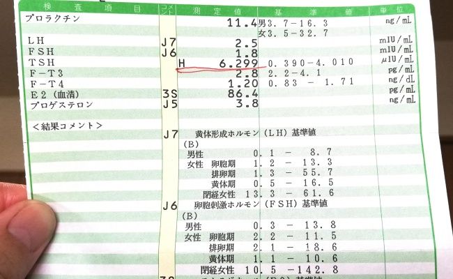 血液検査の結果