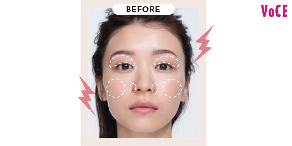 BEFORE 頰に広がる赤み、小鼻のキワを囲む濃いめの赤み、まぶたの茶ぐすみ