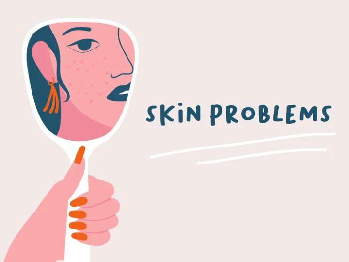 毛穴 原因 正しいケア 2