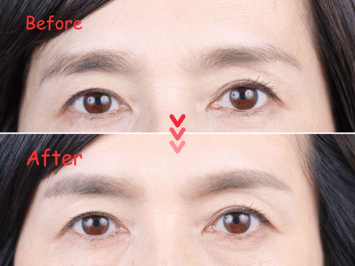 豊田真由美さんの眉毛のbefore→after