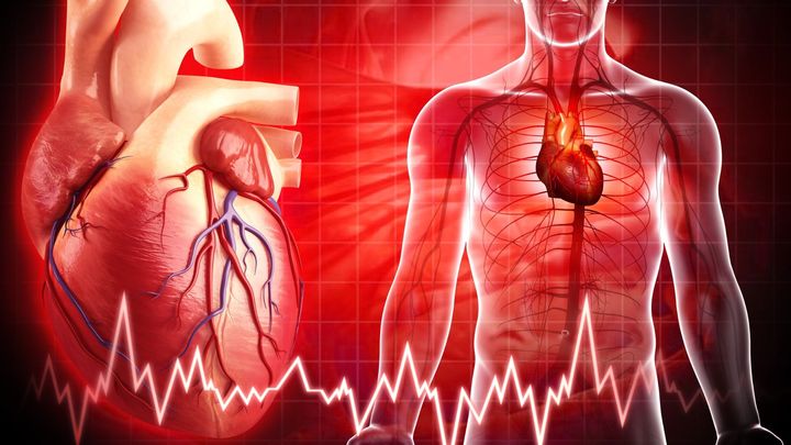 細菌と心臓発作の意外なつながり