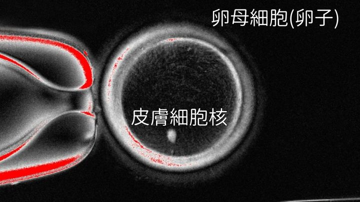 ヒト皮膚細胞から卵子を作り受精させ初期胚まで成長させることに成功！