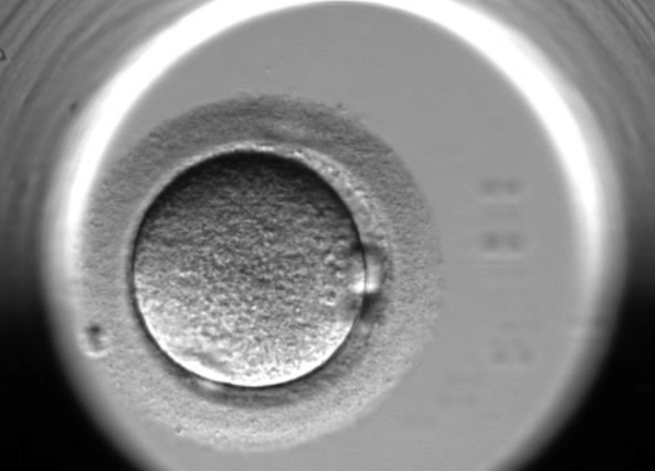 活性化したヒト人工受精卵