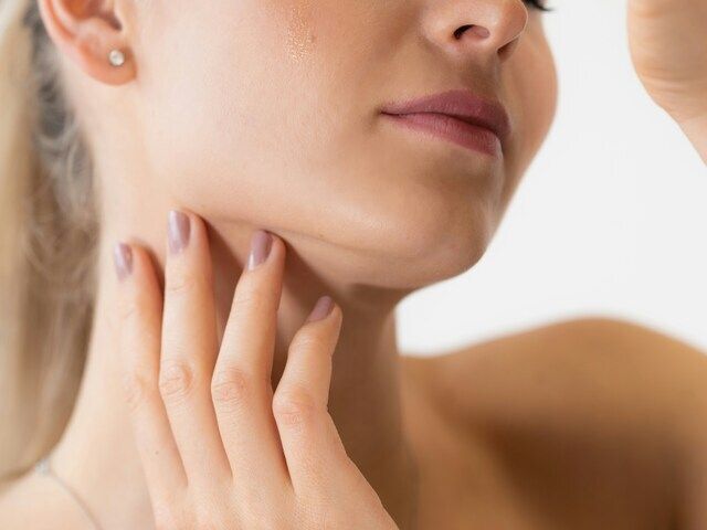 フェイスライン