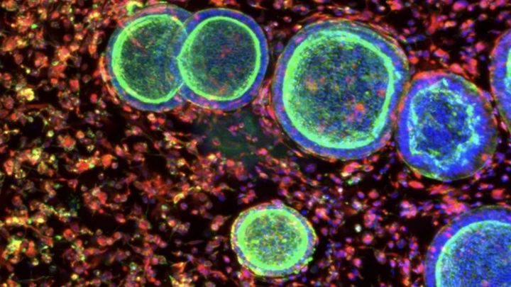 月経を再現する試「ミニ子宮」を作成することに成功！