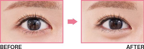 ぷっくり自然な涙袋が爆誕！BEFORE、AFTER