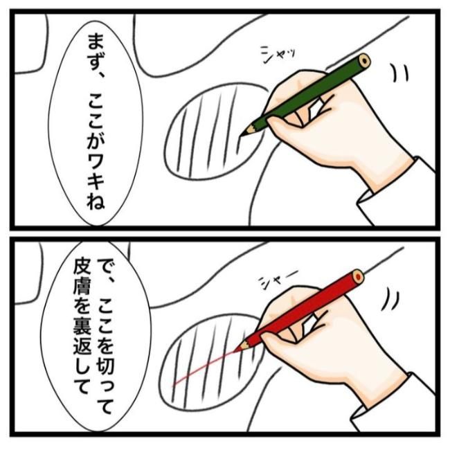 ワキガ治療で搬送された話／すがのみさき