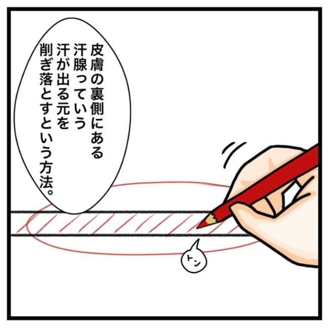 ワキガ治療で搬送された話／すがのみさき