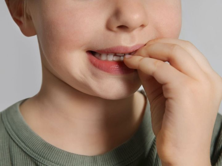 【児童精神科医が解説】爪かみ、抜毛、皮膚むしりなどの「やめられないクセ」はありませんか？ 直らないクセが原因で、体に傷跡が残ったり、自尊心が損なわれたりするケースもあります。臨床試験で効果が確認された「クセ置き換え療法」について、分かりやすく解説します。※画像：Shutterstock.com