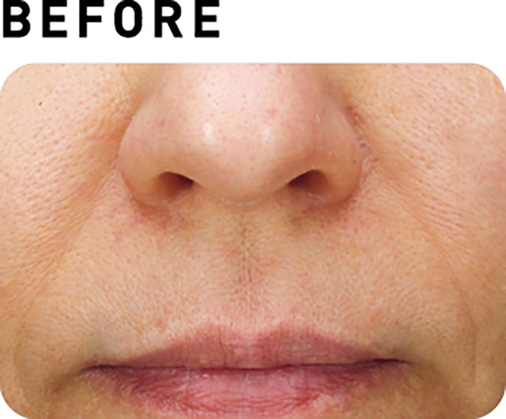 サブライム【BEFORE】