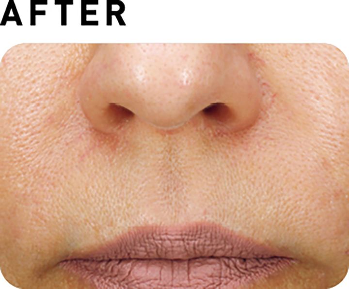 サブライム【AFTER】