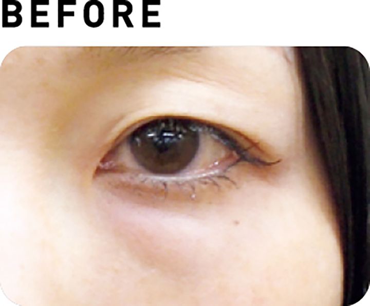 サーマクールアイ【BEFORE】