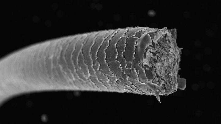 白髪か、がんか――白髪化が体を守るメカニズム