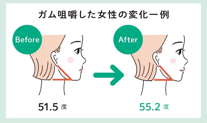 ガム咀嚼した女性の変化一例