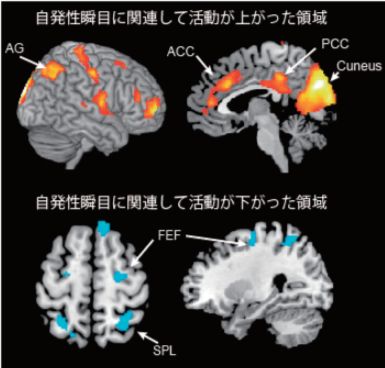 上：瞬きをすると活動が上がる領域 下：瞬きをすると活動が下がる箇所