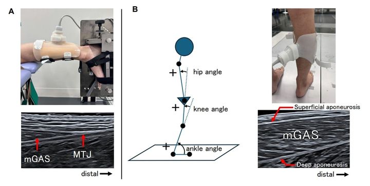 『腱トレ』で転倒リスクを下げられるか？