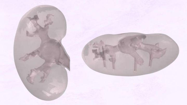 実験で使用された人工の腎臓モデル