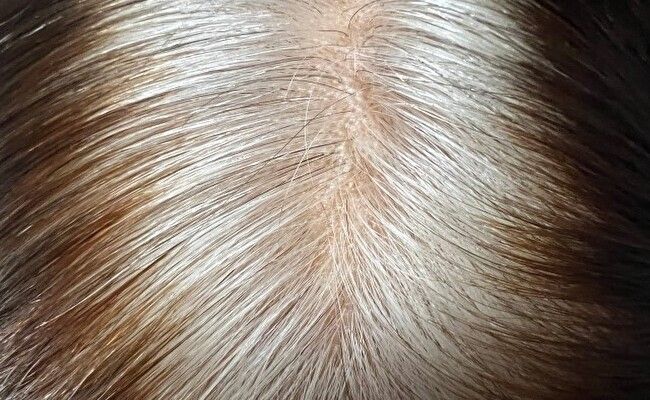 髪の根本が白髪になっている様子
