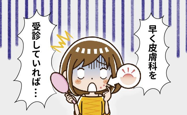 肌トラブル イメージイラスト