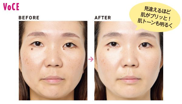見違えるほど肌がプリッと！ 肌トーンも明るく