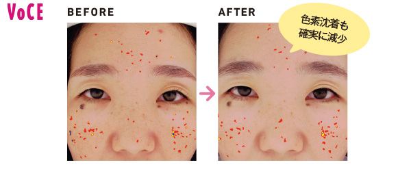 色素沈着も確実に減少