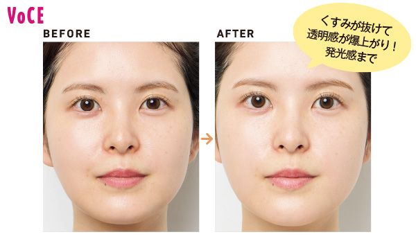 くすみが抜けて透明感が爆上がり！ 発光感まで