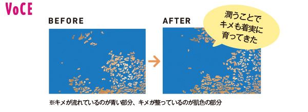 潤うことでキメも着実に育ってきた