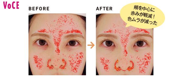 頰を中心に赤みが軽減！ 色ムラが減った