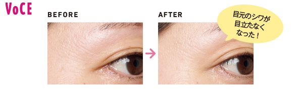 目元のシワが目立たなくなった！