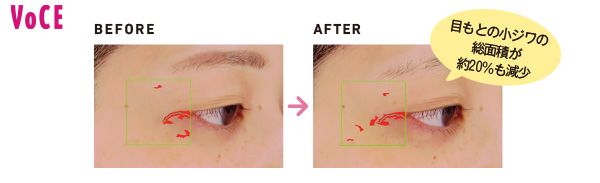 目もとの小ジワの総面積が約20%も減少