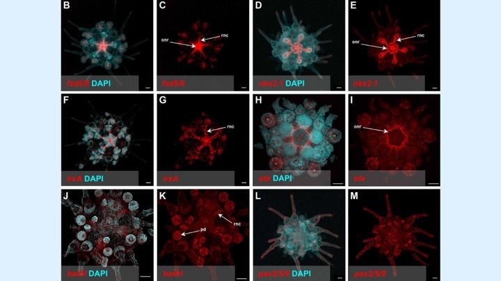 ウニの体は「巨大な脳」だった