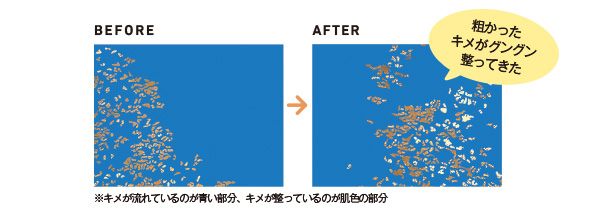 粗かったキメがグングン整ってきた