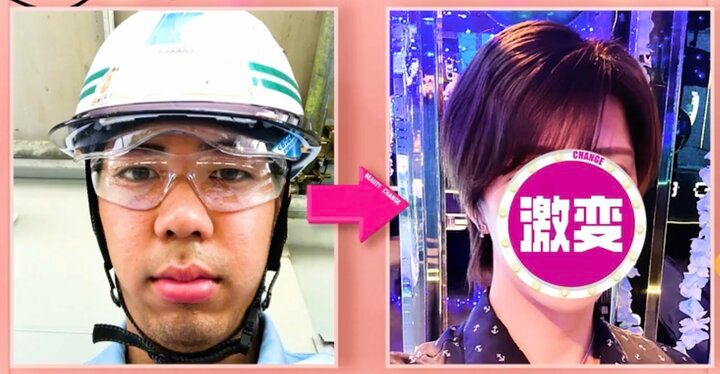 【写真・画像】整形費用330万円で激変！髙橋海人似ホストのビフォーアフターに衝撃「これは人生変わる」「整形顔っぽくない」 1枚目