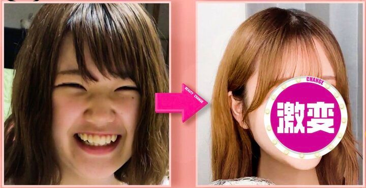 【写真・画像】2日に1回の深夜ラーメンで激太り！“69キロ→44キロ”美女のビフォーアフターに衝撃「顎にがんもどきが生えてるって言われていた」 1枚目
