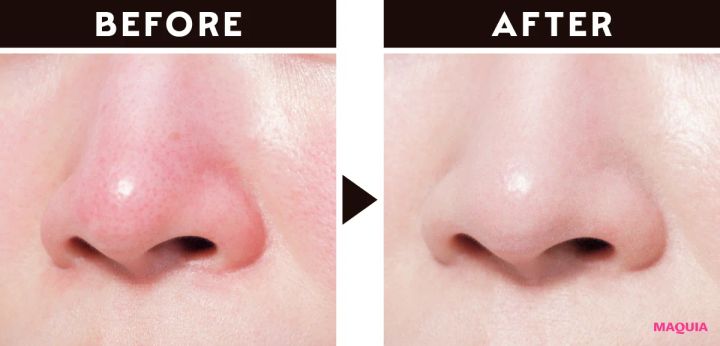 鼻まわりの赤み隠しにおすすめのメイク ビフォーアフター