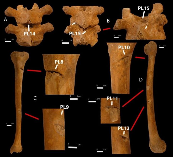 骨に残った傷跡