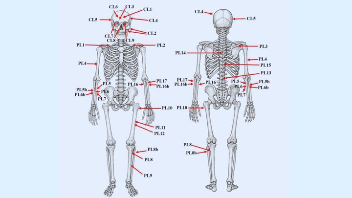 26ヵ所の傷後の分布