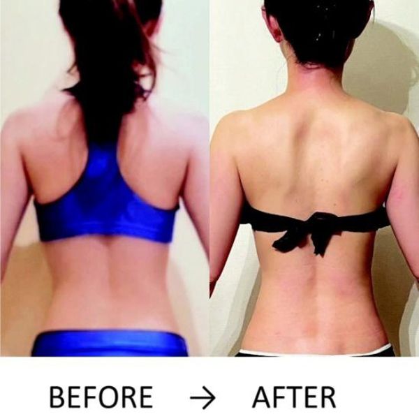 ■47歳、脚のむくみが取れてウエストにもくびれが！