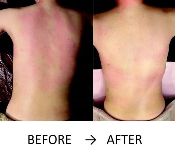 ■50歳、むくみとぜい肉がとれて10kg痩せた！