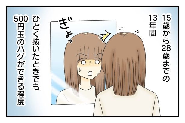 500円玉のハゲができることも… 4-1 画像提供：春乃おはなさん