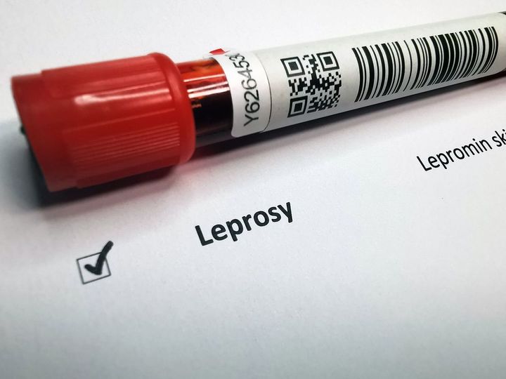 ハンセン病血液検査