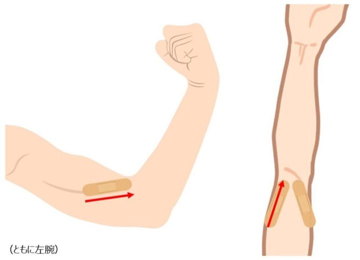 肘カイロのポイント１