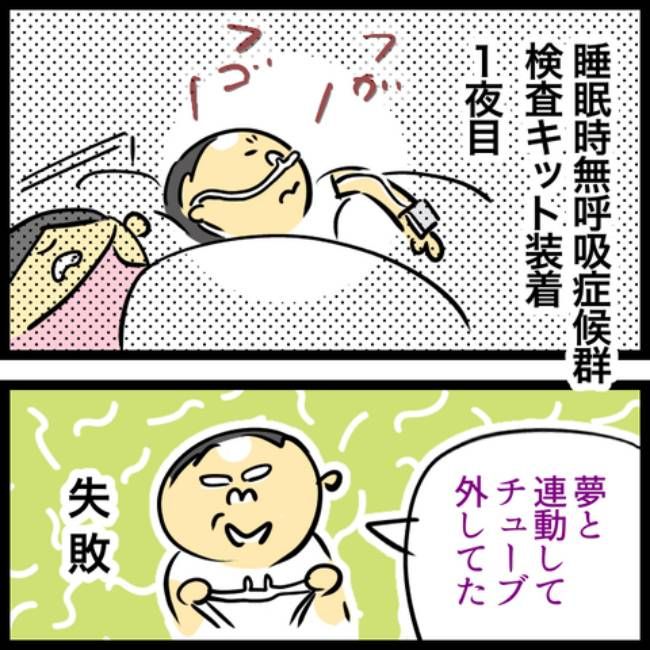睡眠時無呼吸症候群の夫／へそ